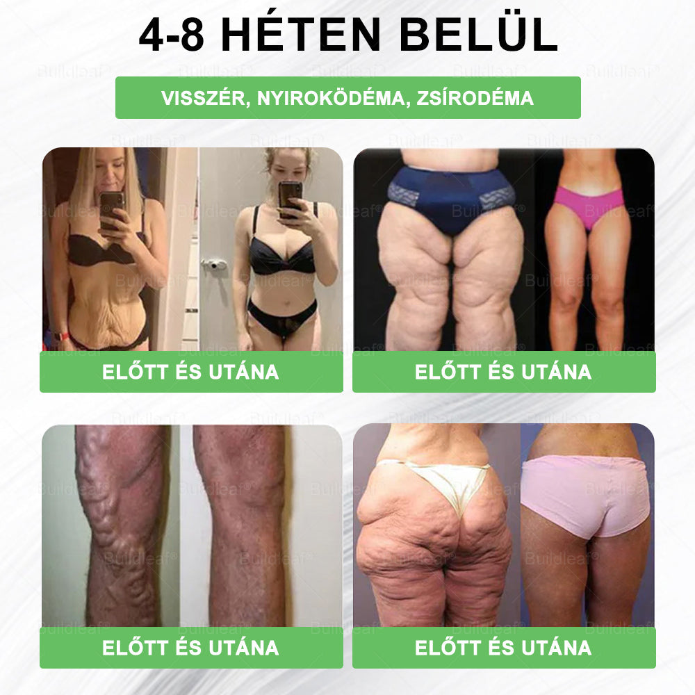đđș Klinikai kutatĂĄsokkal igazolt | A BuildLeafÂź Berberine GLP-1 Pro SĂșlycsökkentĆ SzĂĄjon ĂĄt szedhetĆ oldat segĂthet a makacs sĂșlytöbblet, anyagcsere- Ă©s energiaproblĂ©mĂĄk kezelĂ©sĂ©ben, tĂĄmogatva a jobb közĂ©rzetet Ă©s vitalitĂĄst