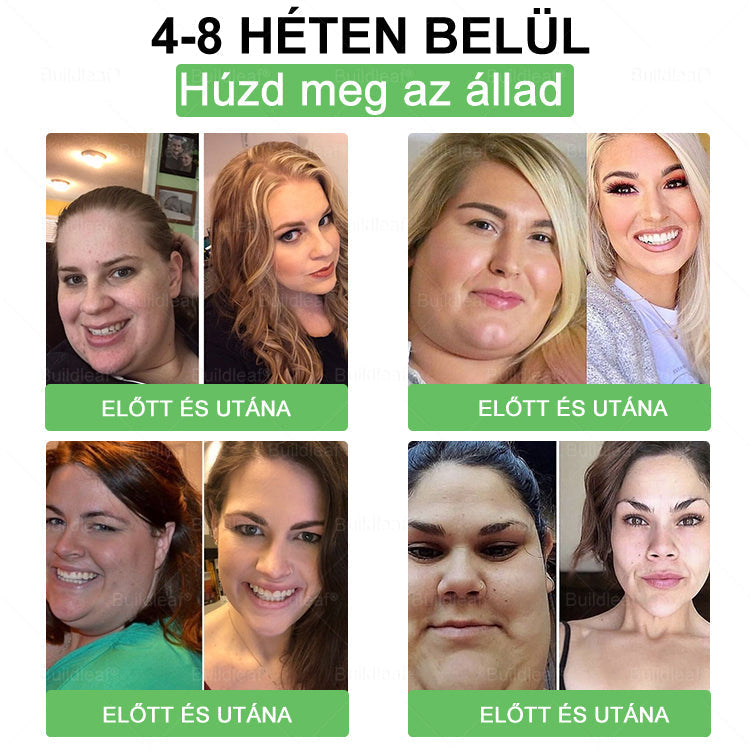 đđș Klinikai kutatĂĄsokkal igazolt | A BuildLeafÂź Berberine GLP-1 Pro SĂșlycsökkentĆ SzĂĄjon ĂĄt szedhetĆ oldat segĂthet a makacs sĂșlytöbblet, anyagcsere- Ă©s energiaproblĂ©mĂĄk kezelĂ©sĂ©ben, tĂĄmogatva a jobb közĂ©rzetet Ă©s vitalitĂĄst