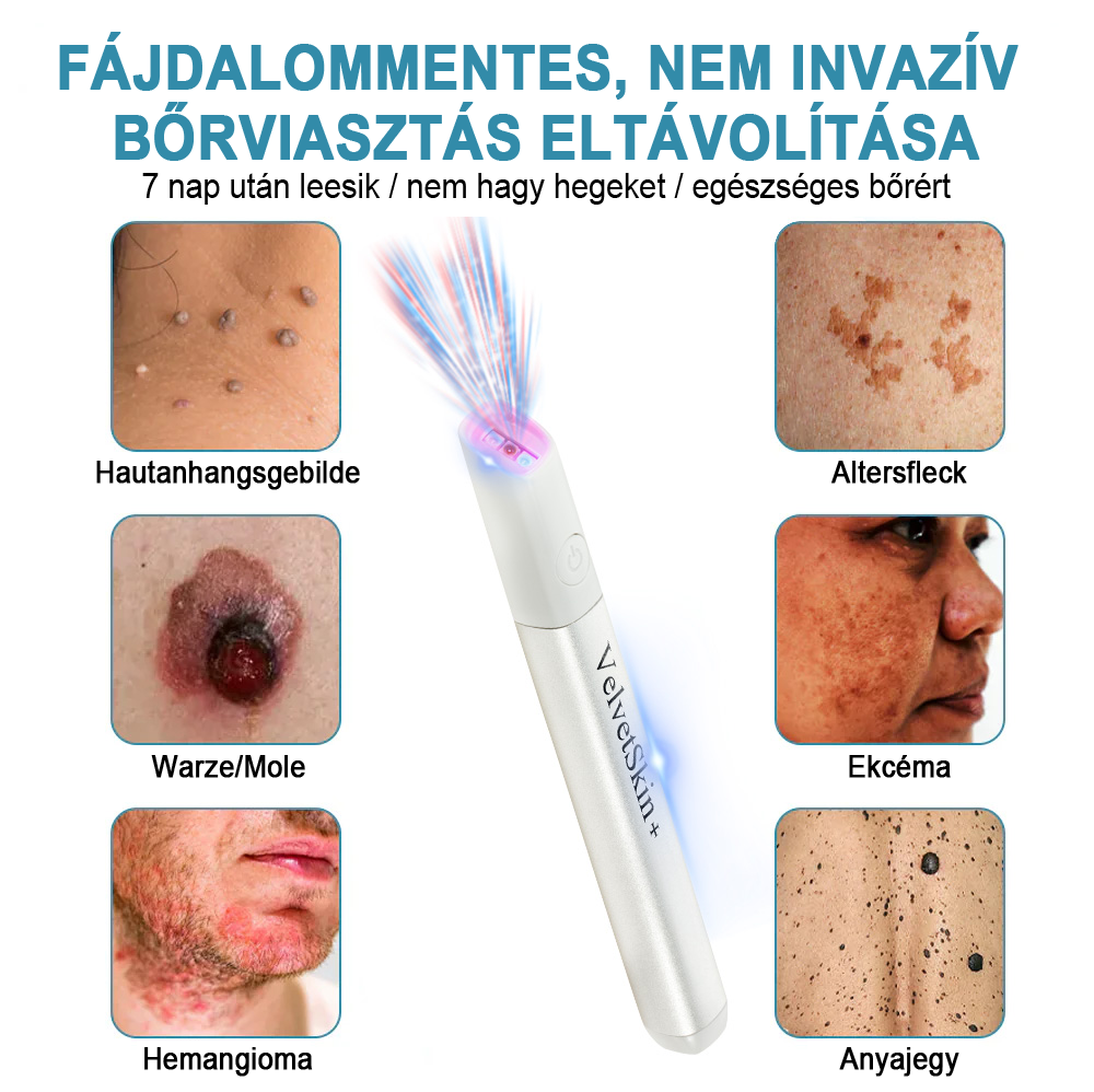 ✨ Bikenda®  – Laserowy Długopis CO₂ do Usuwania 🟤 Znamion, 🦠 Brodawek, 🔘 Przebarwień i Innych Niedoskonałości Skóry）🩹