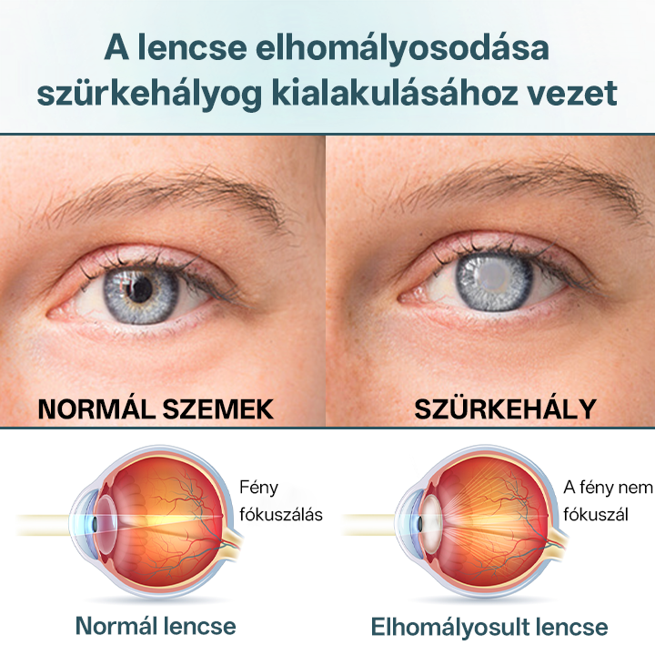 Timilk® OptiFusion Nano szemcsepp szérum🟪