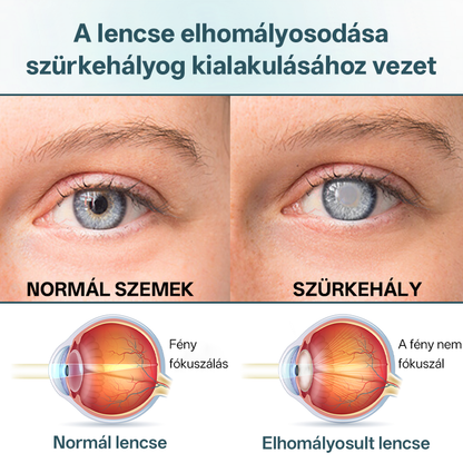 Timilk® OptiFusion Nano szemcsepp szérum🟪