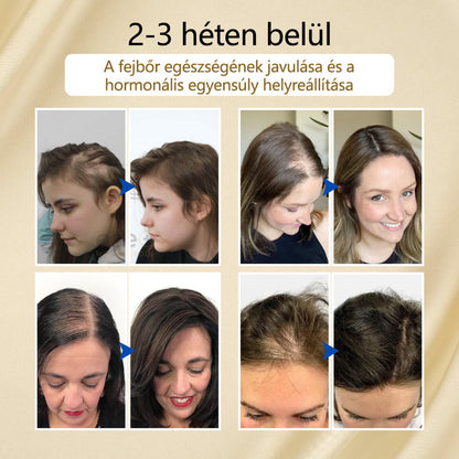 Timilk® VitaStrand Biotin hajnövekedést elősegítő spray✅ Sűrű, fényes haj néhány hét alatt💚