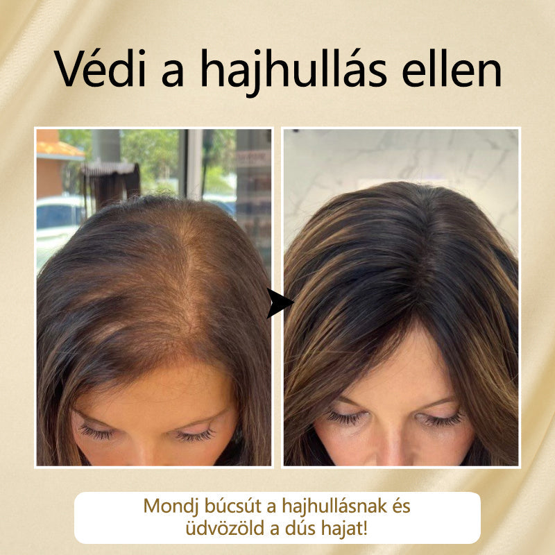 Timilk® VitaStrand Biotin hajnövekedést elősegítő spray✅ Sűrű, fényes haj néhány hét alatt💚