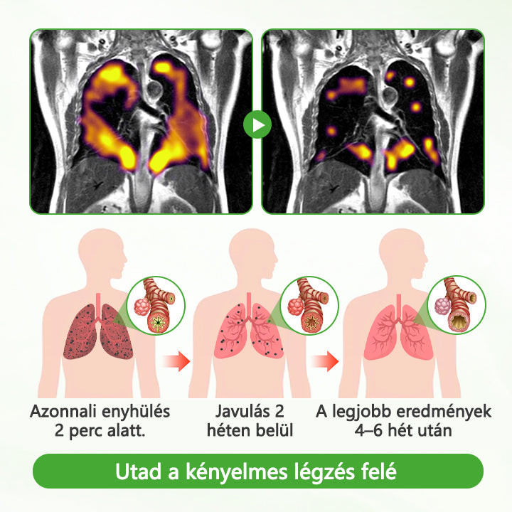 Friss Légzés, Szabad Élet – Ismerje meg a Timilk® HerbaAir erejét!✅❇️