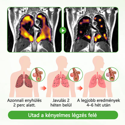 Friss Légzés, Szabad Élet – Ismerje meg a Timilk® HerbaAir erejét!✅❇️