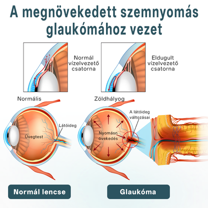 Timilk® OptiFusion Nano szemcsepp szérum🟪